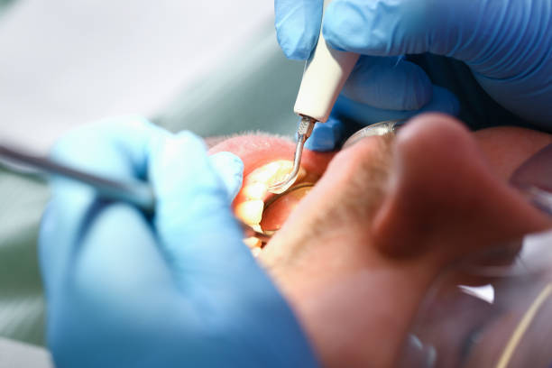 Best Emergency Tooth Extraction  in Brown Station, MD